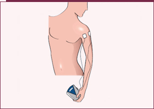 Botgroeistimulatoren Osteobit Plus