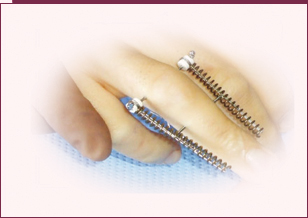 Ligamentotaxor